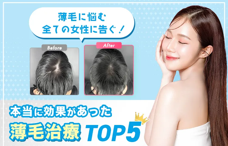 薄毛に悩む全ての女性に告ぐ！本当に効果があった薄毛治療TOP5