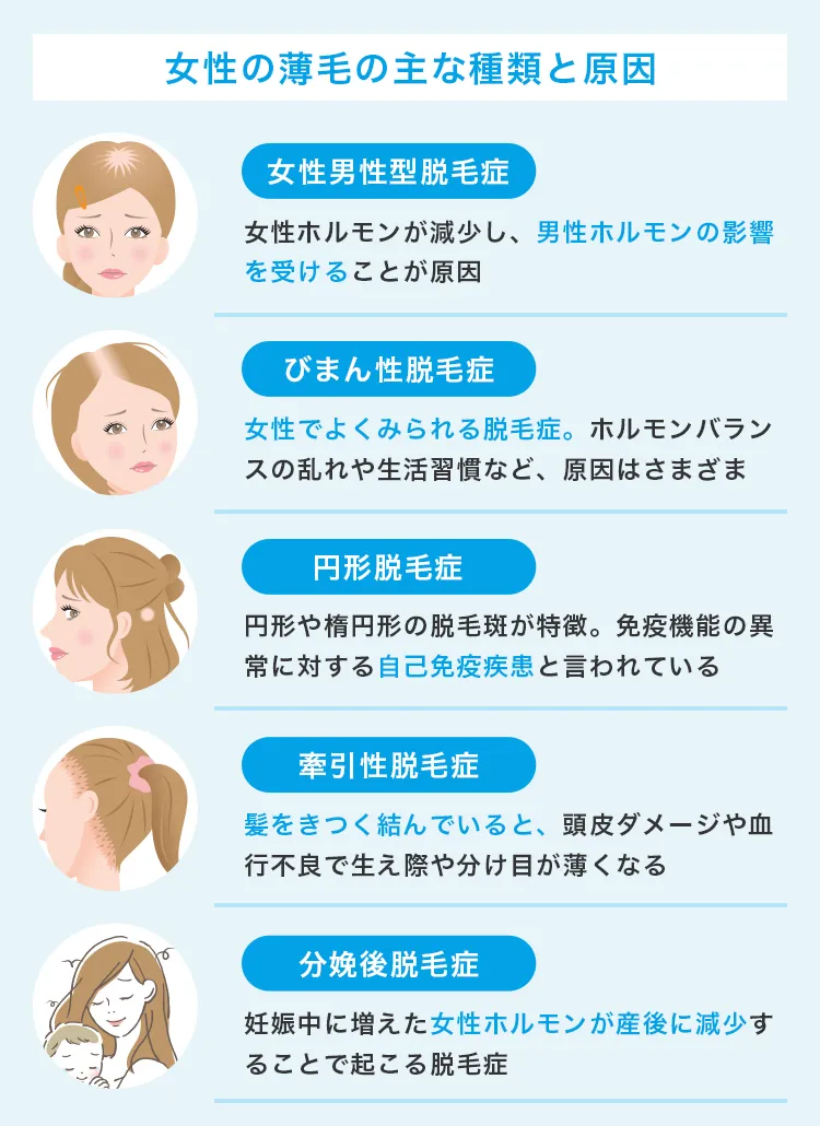 女性の薄毛の主な種類と原因